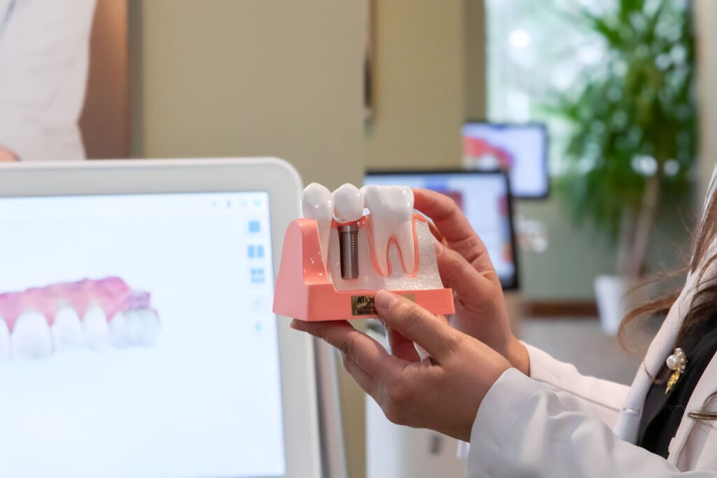 different types of dental implants