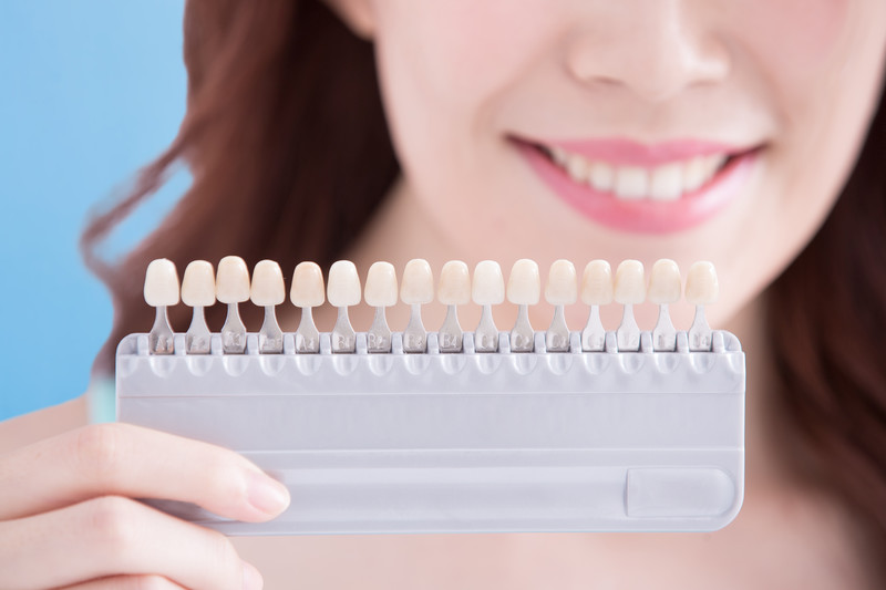veneers