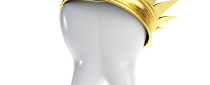 When Do You Need a Dental Crown? Key Signs